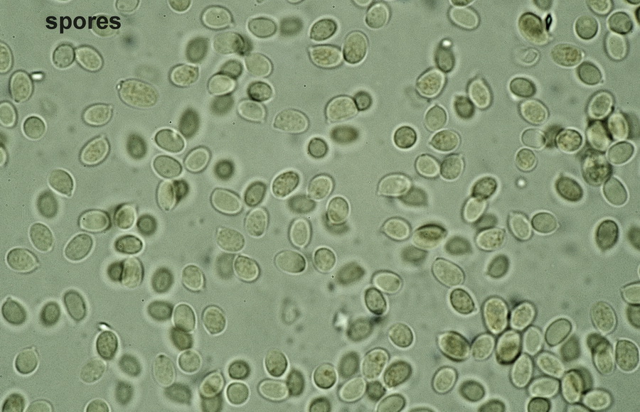 Xylodon asperus spores Melzer.JPG