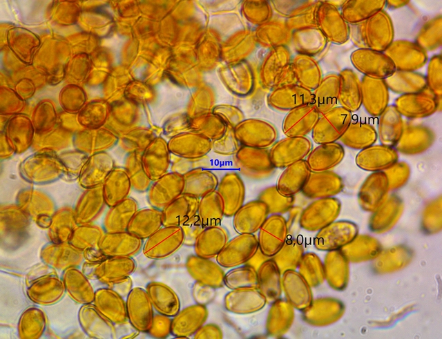 Paneoles spores x 1000.JPG