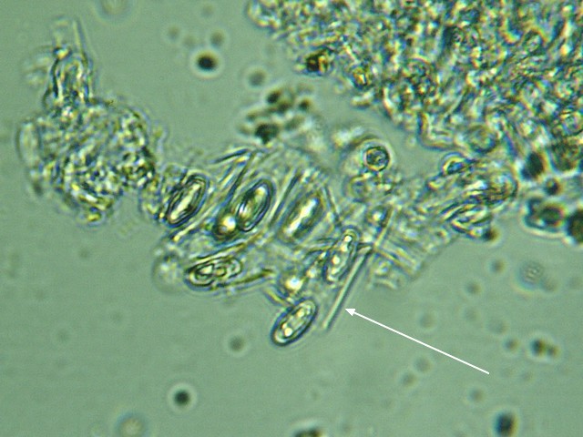 Asques et spores Otidea.jpg