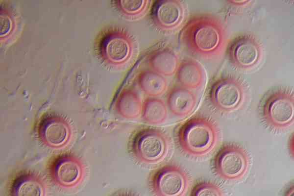 Spores elaphomyces granulatus.JPG