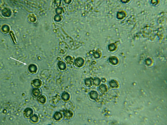 spores crtsitata.jpg