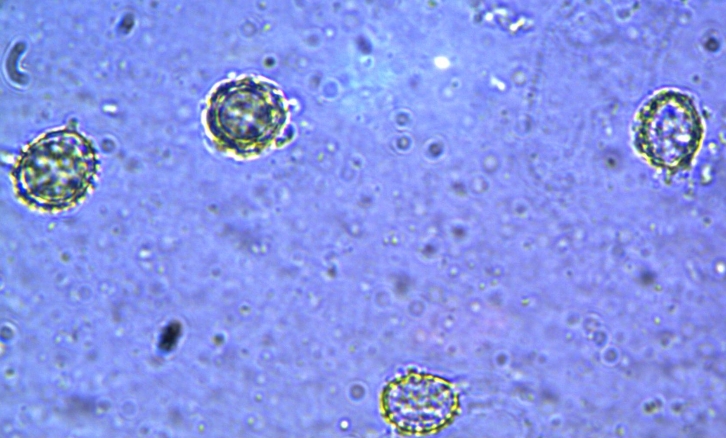 spores russule blanche1-redim726.jpg