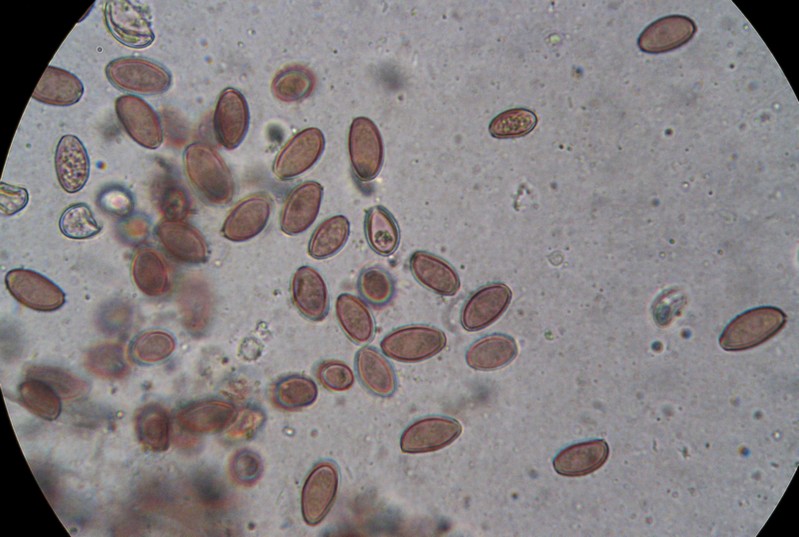 Spores Stropharia aurantiaca.jpg