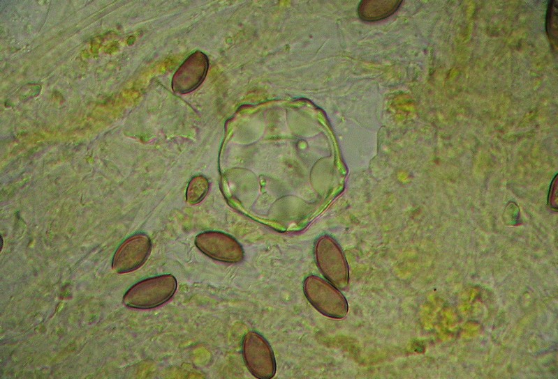 Spores Stropharia aurantiaca + pollen.jpg