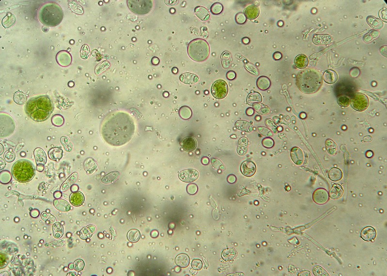 Ascospores + algue.jpg