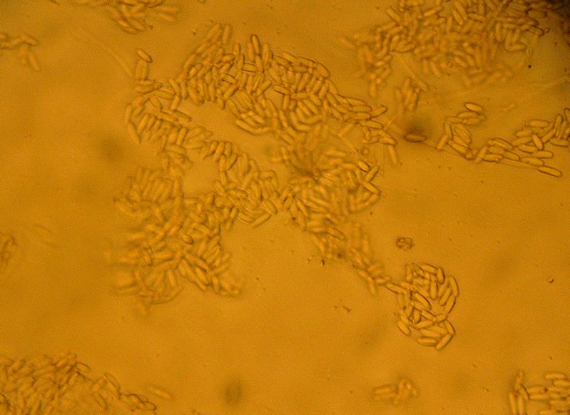 Spores Basidio.jpg