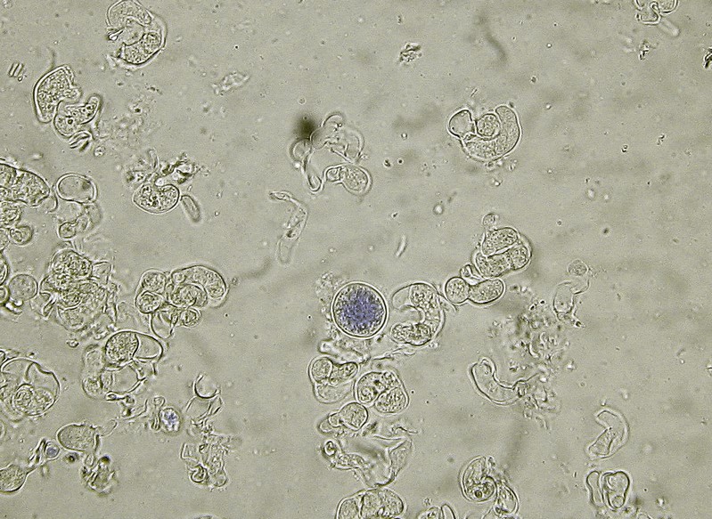 Conidies Illosporiopsis.jpg