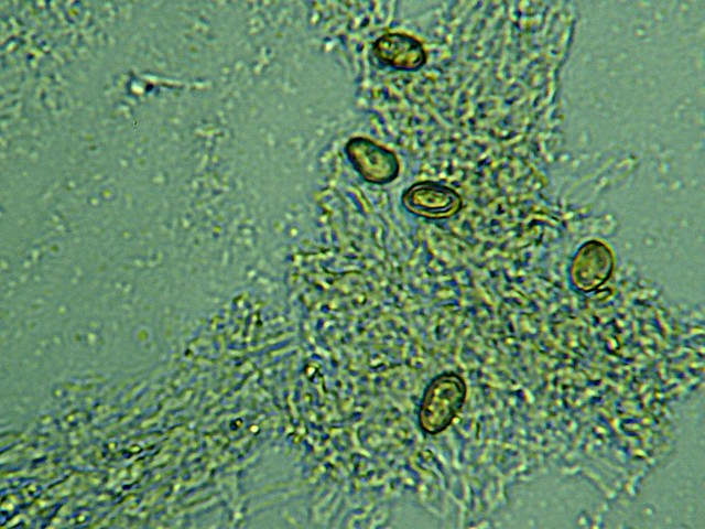 Spres C; puteana  12.5 µm X 7.5 µm.jpg