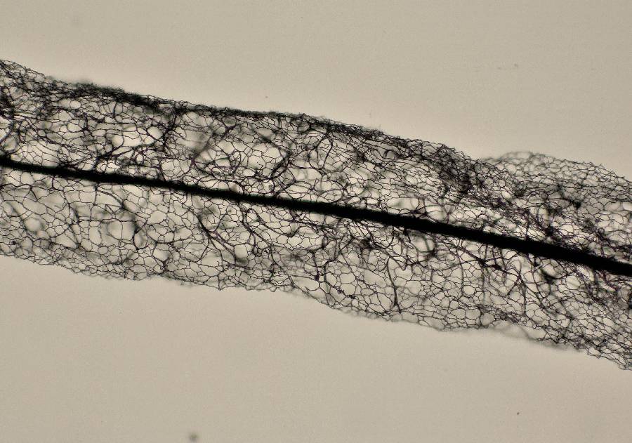 4 Stemonitis flavogenita (à confirmer) 2014 07 07 Lozère (Cévennes) (5).jpg