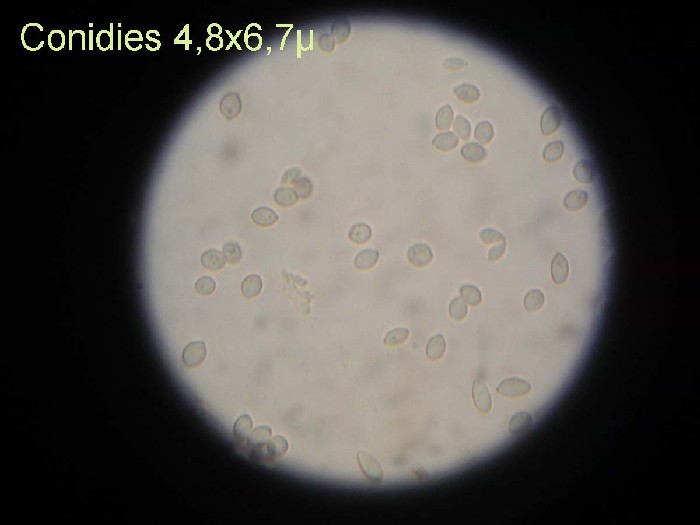 Geniculosporium xxx3m-redim700.jpg