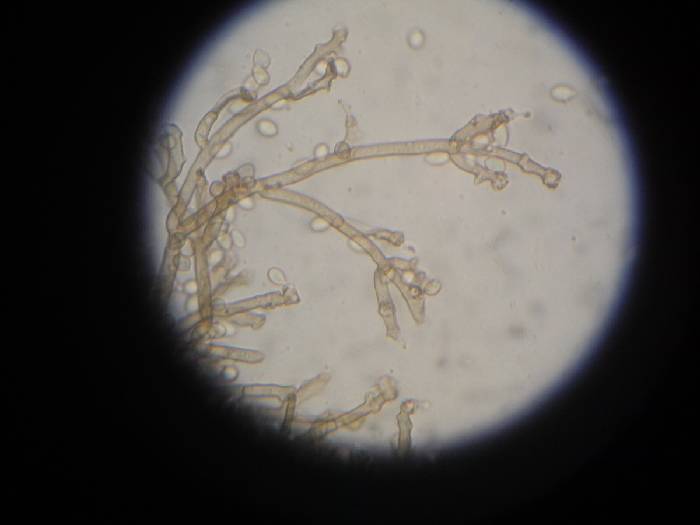 Geniculosporium xxx2.JPG