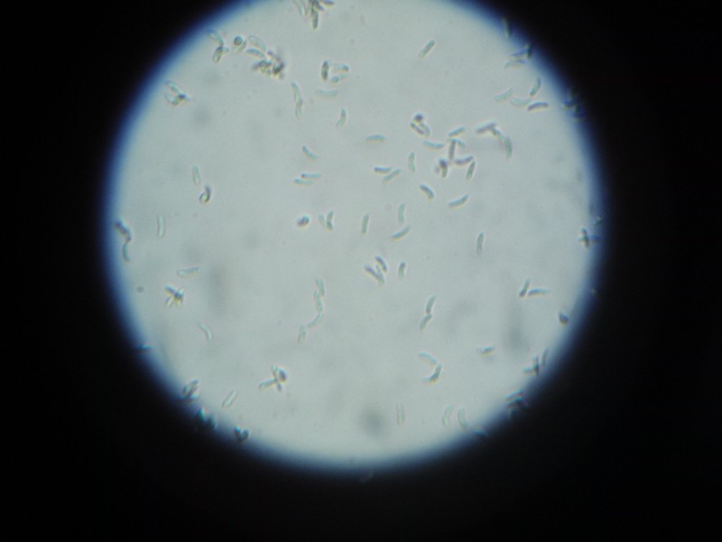 Spores.JPG